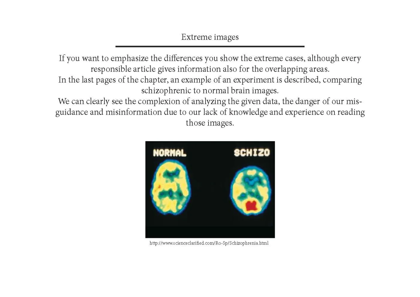Dumit, Joseph, Picturing Personhood: Brain Scans and Biomedical Identity
