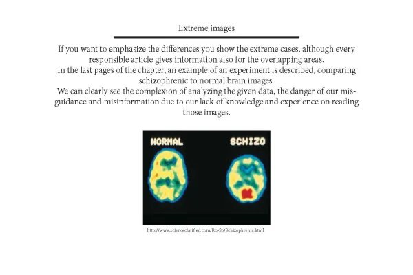 Dumit, Joseph, Picturing Personhood: Brain Scans and Biomedical Identity