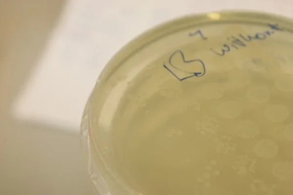 IST (documentation: working session with bacteria, fluorescent genes)