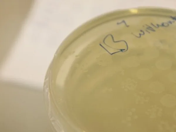 IST (documentation: working session with bacteria, fluorescent genes)
