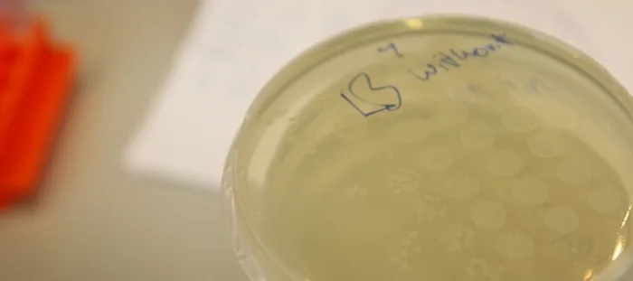 IST (documentation: working session with bacteria, fluorescent genes)