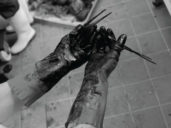 Polytrauma