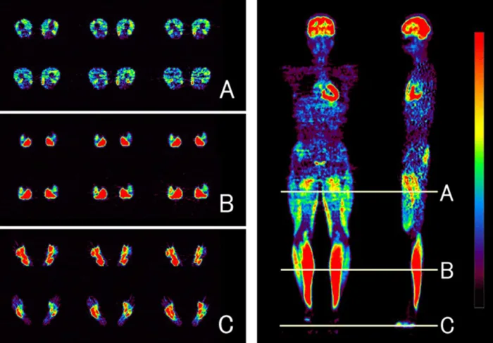 Molecular Imaging, running. Photo © Manabu Tashiro