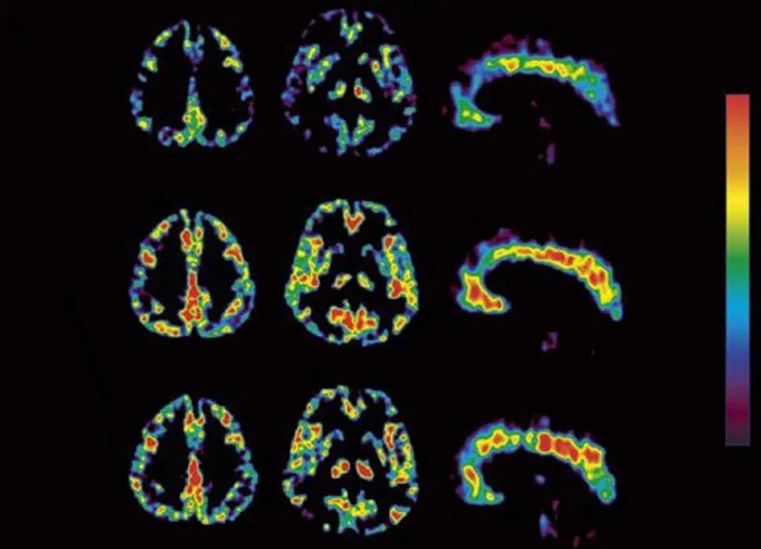 Molecular Imaging, Antihistamine H1RO. Photo © Manabu Tashiro