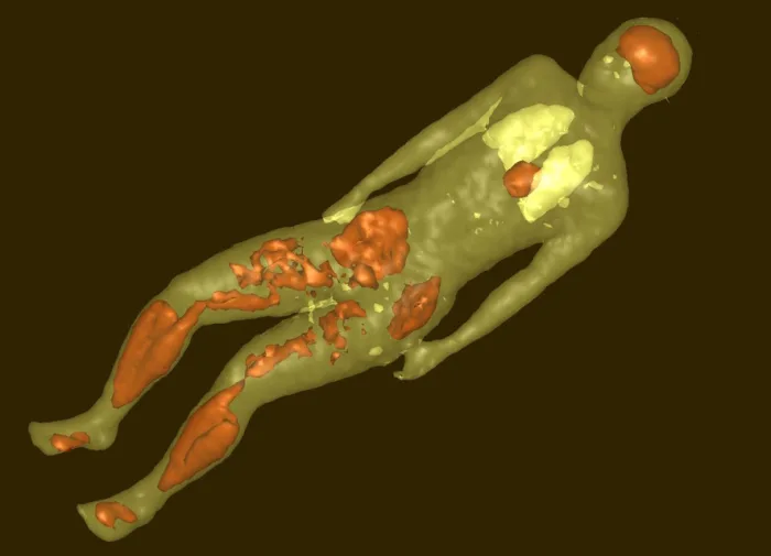 Molecular Imaging, running. Photo © Manabu Tashiro